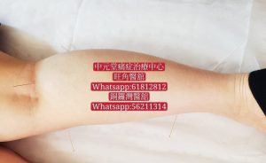 腳痛的病因:足底筋膜炎、痛風、外傷、骨性關節炎、類風濕關節炎、腰椎病變以及感染 141332213 1925915754224555 7503141671900985187 o 1
