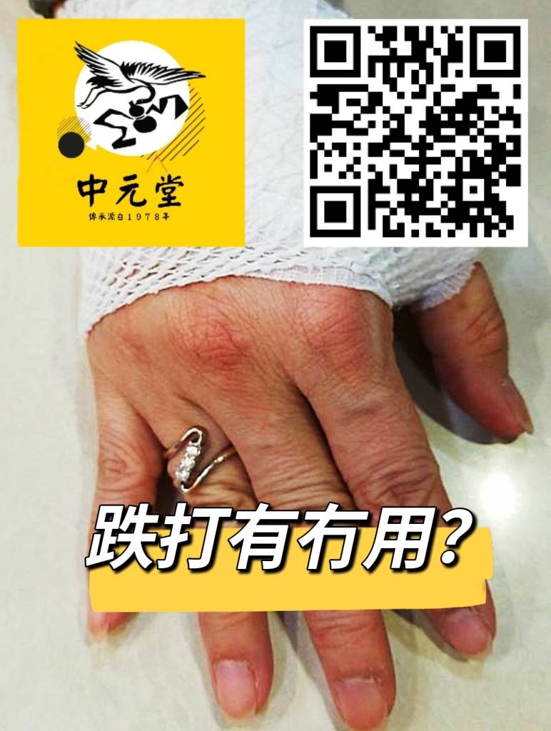 跌打有冇用?骨傷科中醫師跟你作出分享
