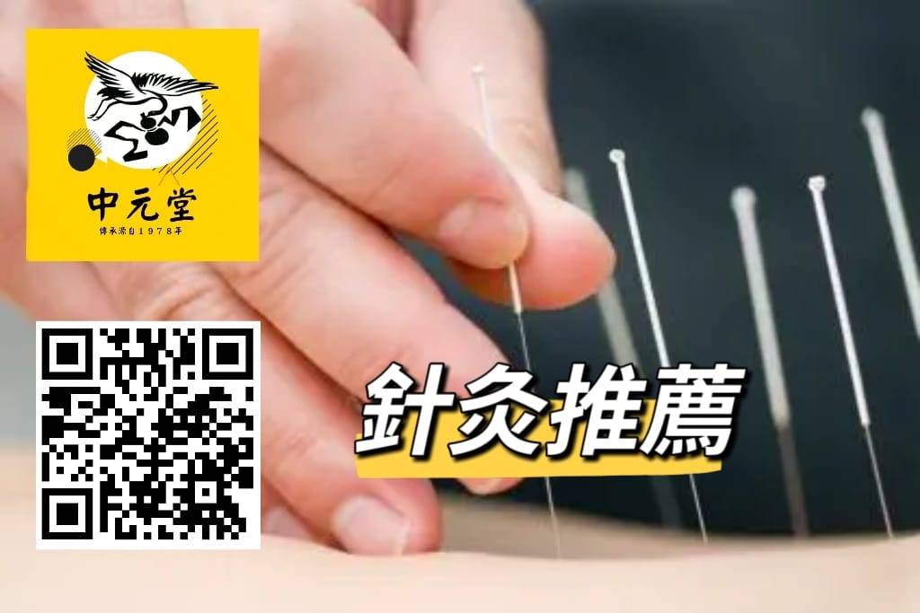 針灸推薦,舒緩疼痛,中元堂中醫診所幫到你